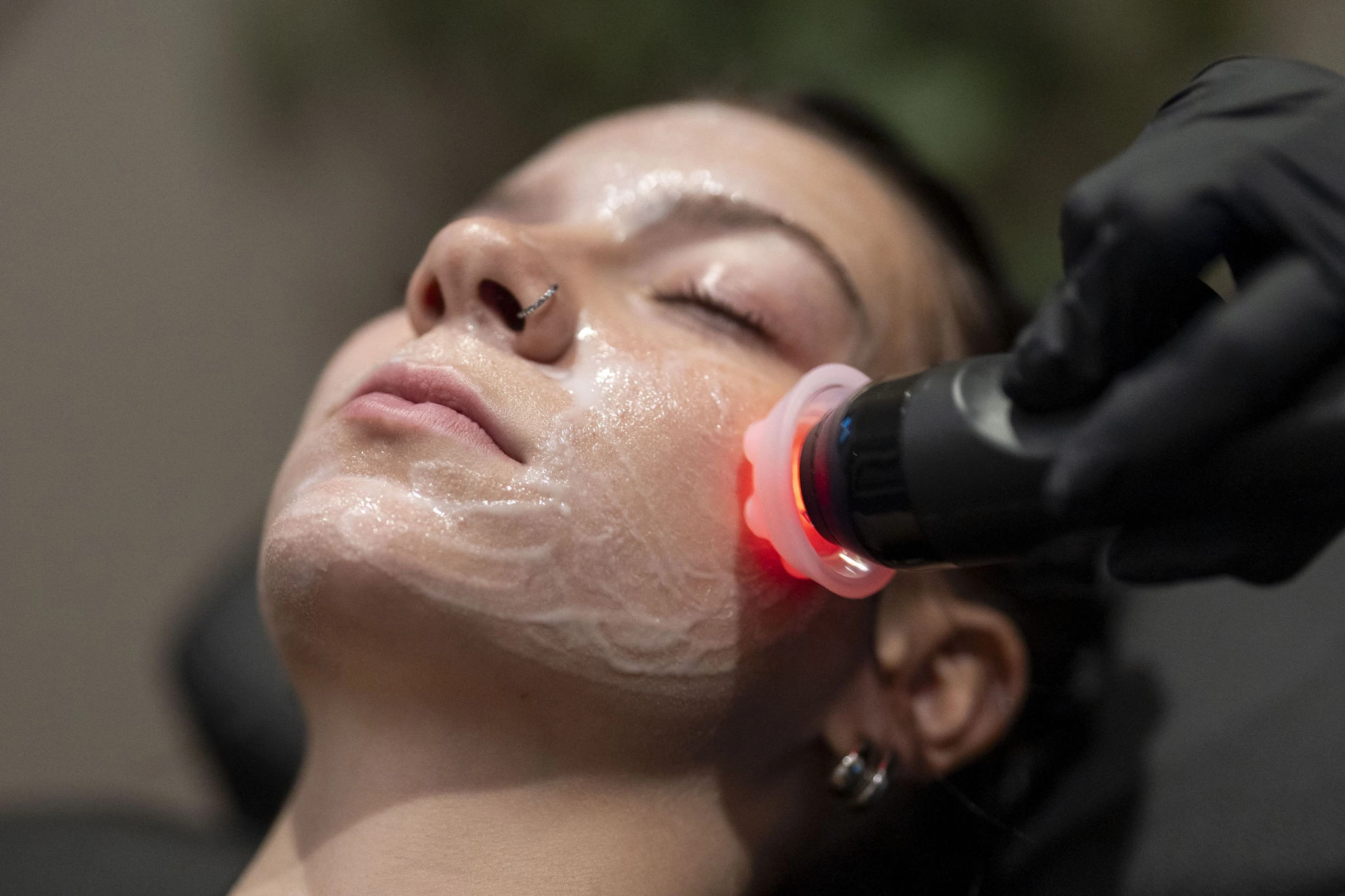 Girl getting Aesthetic Treatments | Culture Aesthetics and Wellness | Knoxville, TN